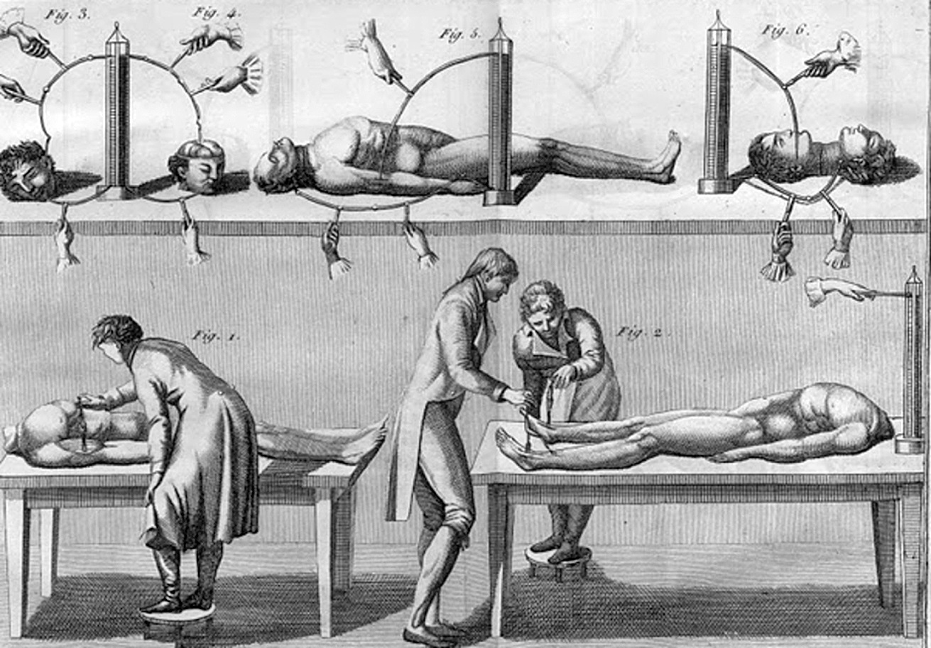 Gli esperimenti di Giovanni Aldini sui cadaveri decapitati illustrati da Laurent Pêcheux